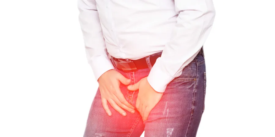 Varicocele
