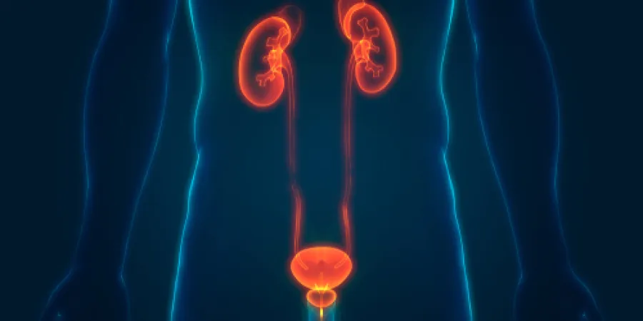 Los factores que pueden aumentar el riesgo de cáncer de vejiga.