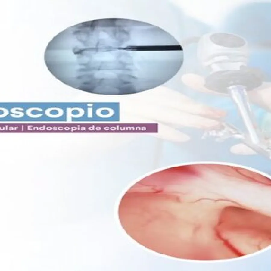 I SIMPOSIO DE NEUROCIRUGÍA A TRAVÉS DE UN ENDOSCOPIO