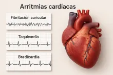 versión realista en 3D y a color en formato de infografía médica mostrando: Un corazón humano en detalle. Electrocardiogramas estilizados (no clínicos) que representen fibrilación auricular, taquicardia y bradicardia. Etiquetas en español para cada tipo de arritmia.