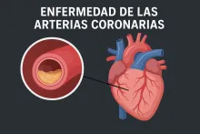 enfermedades coronarias