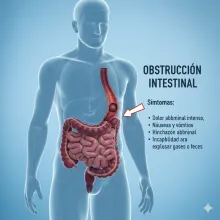 obstrucción intestinal
