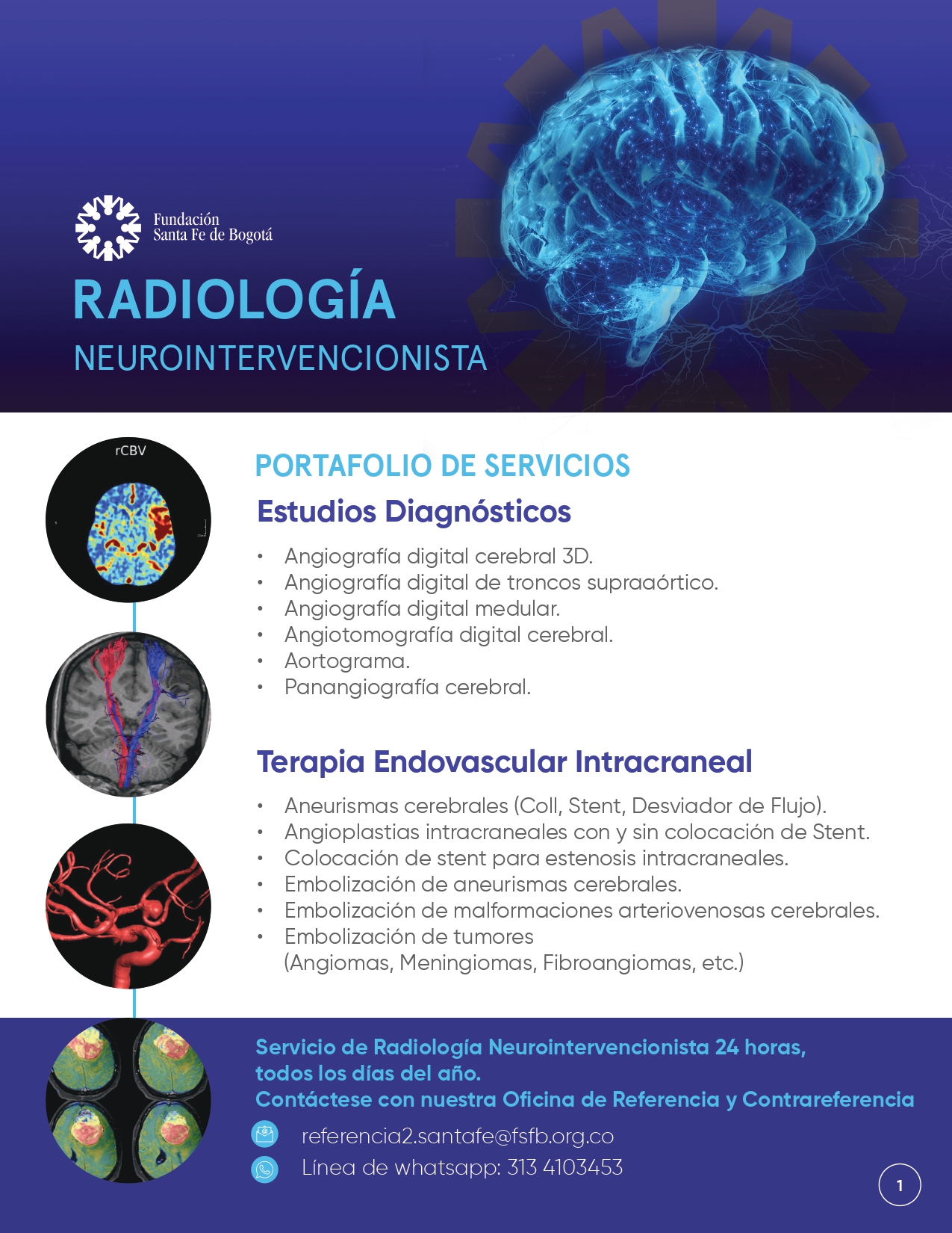neurointervencionismo