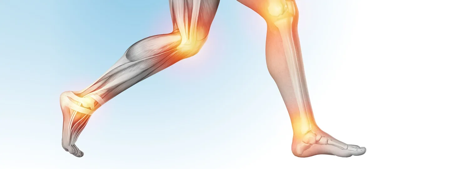 Lesiones en Running/Corredores