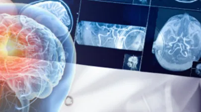 Neurocirugía Para Médicos Generales