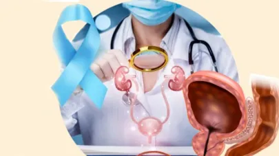 Curso Cáncer de Próstata