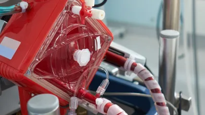 Curso Generalidades de ECMO