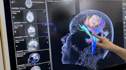 3er Curso de Neurocirugía para Médicos Generales