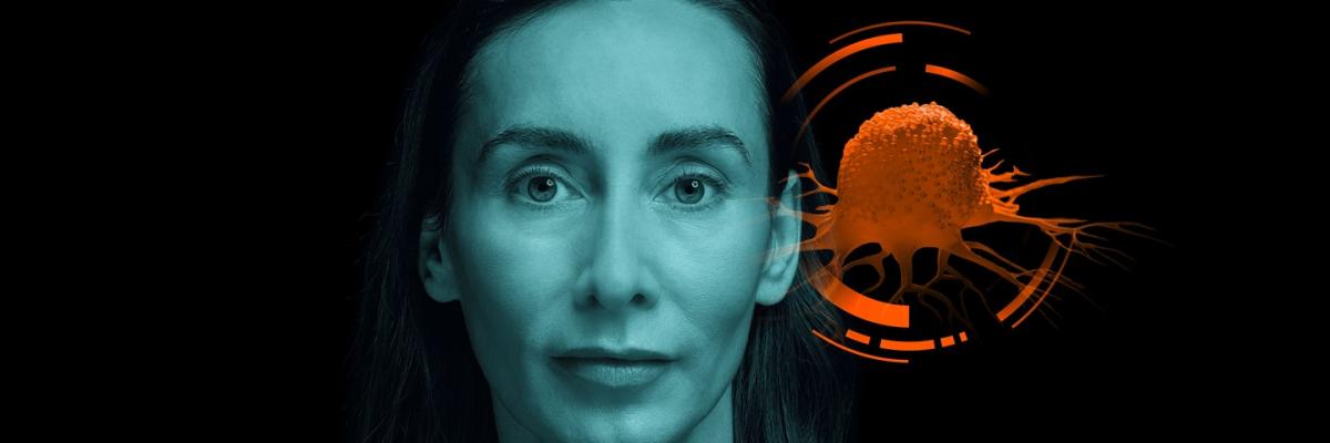Explorando el Teragnóstico con SPECT-CT