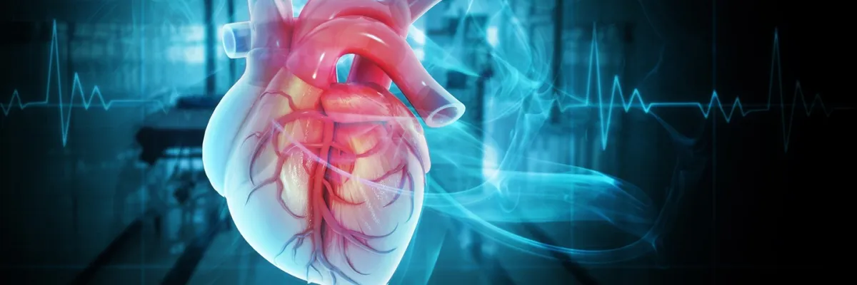 ECMO y Terapias Extracorpóreas
