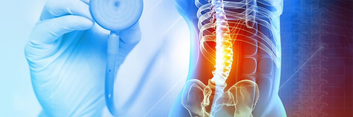 Traumatismos de Columna Cervical