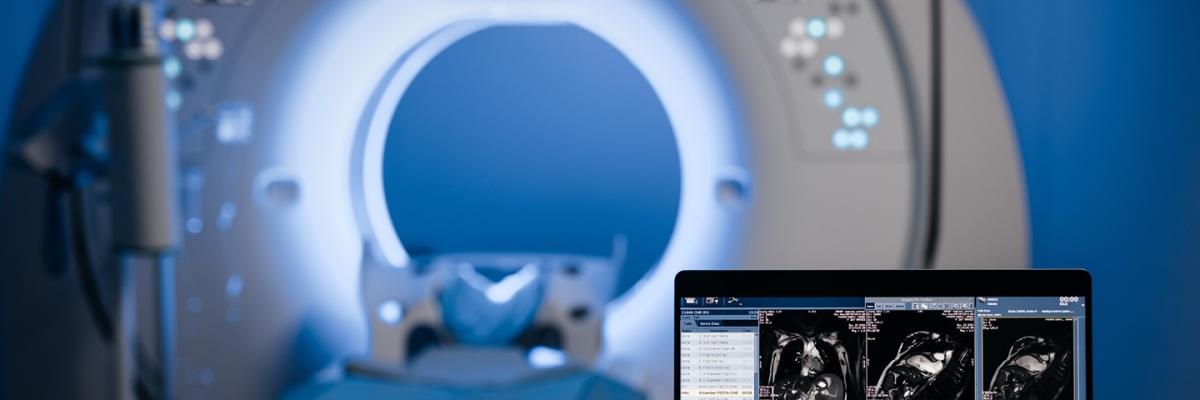 Patología ginecológica en RM, TAC espectral