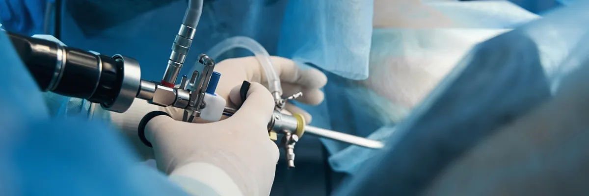 Endoscopia de Columna