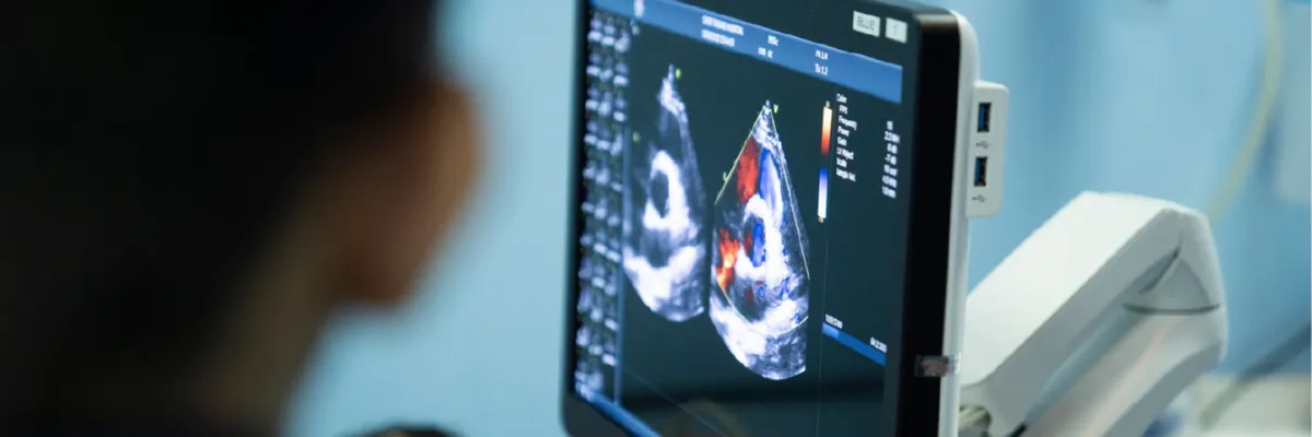 Medicina Crítica y Cuidado Intensivo