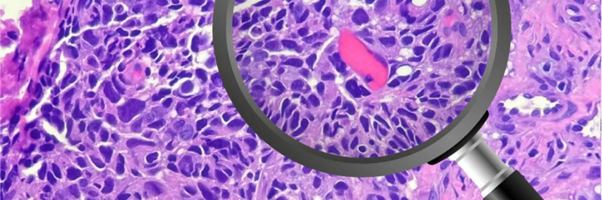 Lesiones Area Maxilofacial