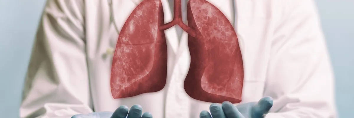 Trasplante Pulmonar en Colombia