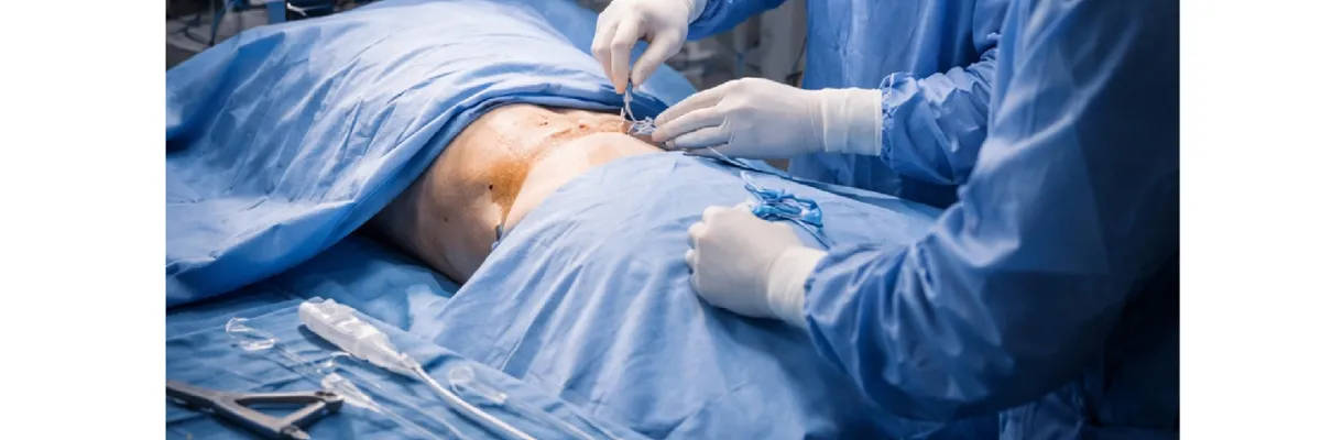 Curso Manejo Percutáneo y Endovascular