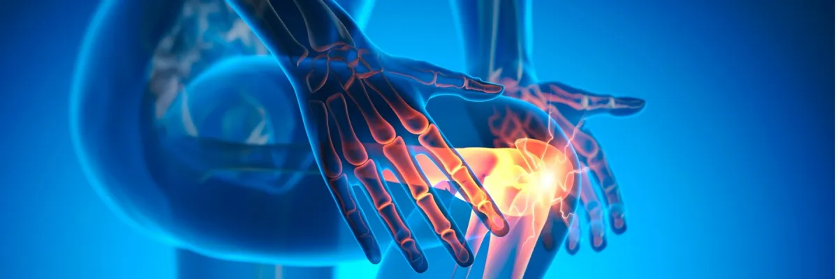 II Encuentro para Pacientes con Artritis Reumatoide