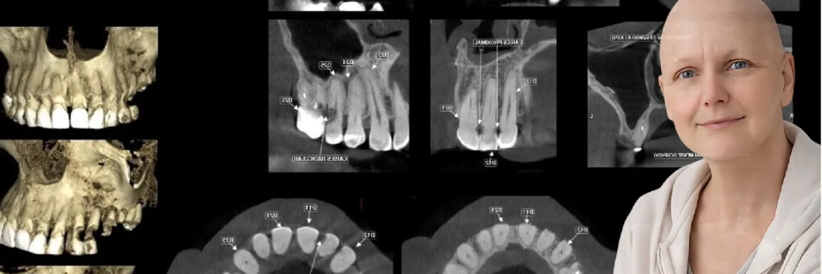 Master Class Oncologia Oral Aplicada