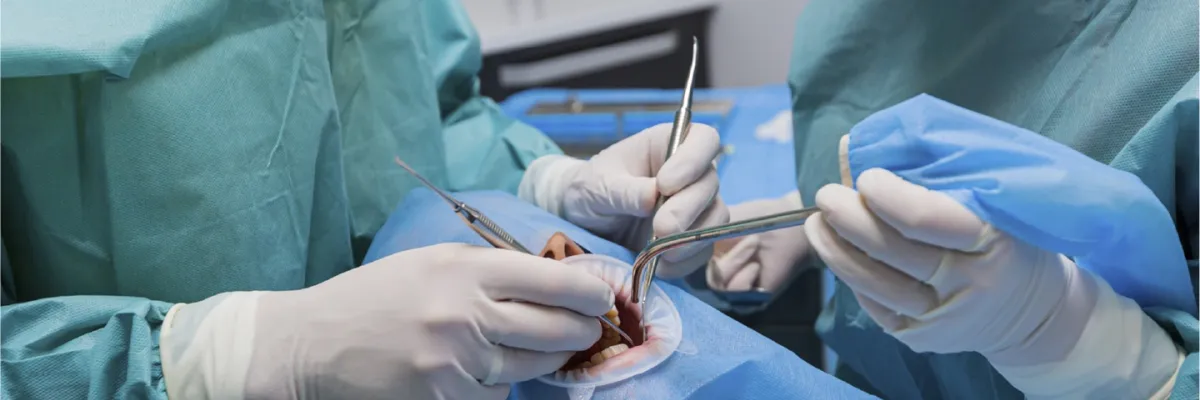 Complicaciones en Cirugia Oral