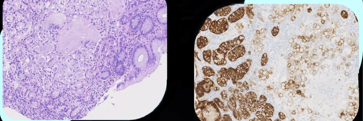 Enfermedad y Patología Gastrointestinal