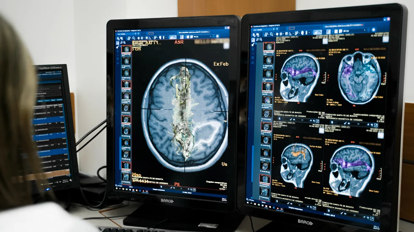 Enfermedades neuronales