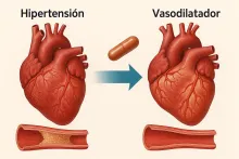 ejemplo efecto vasodilatador en hipertensos